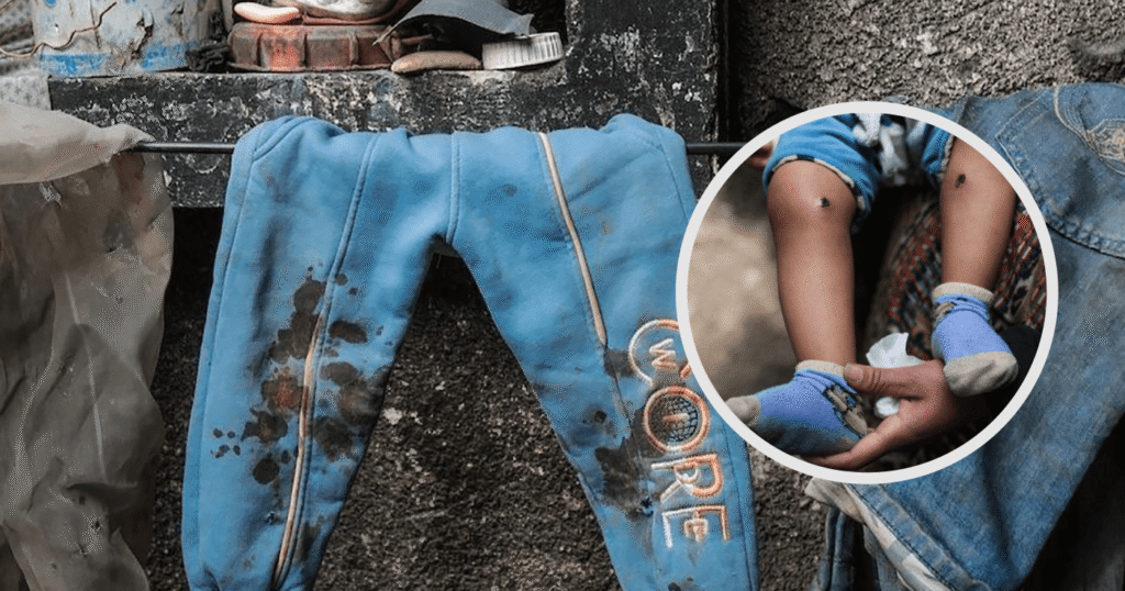 bebe-palestino-torturado:-regime-israelense-volta-a-expor-sua-mentalidade-perversa-e-desumana